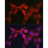 Immunofluorescence - Anti-RhoC Antibody (A308050) - Antibodies.com