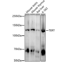 Western Blot - Anti-Telomerase reverse transcriptase Antibody [ARC2711] (A308052) - Antibodies.com