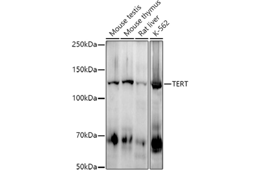 Western Blot - Anti-Telomerase reverse transcriptase Antibody [ARC2711] (A308052) - Antibodies.com