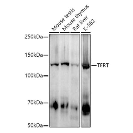 Western Blot - Anti-Telomerase reverse transcriptase Antibody [ARC2711] (A308052) - Antibodies.com