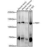 Western Blot - Anti-Telomerase reverse transcriptase Antibody [ARC2711] (A308052) - Antibodies.com