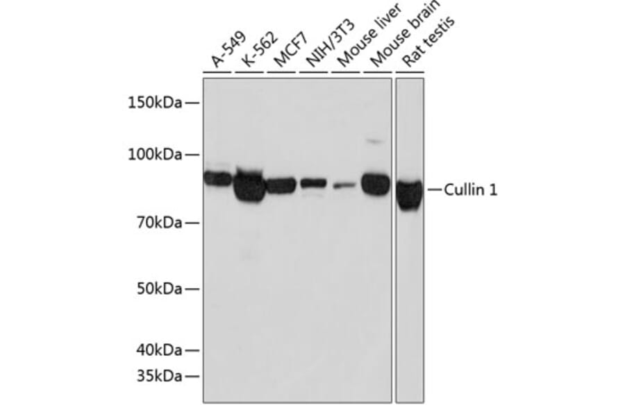 Western Blot - Anti-Cullin 1/CUL-1 Antibody [ARC0436] (A308053) - Antibodies.com