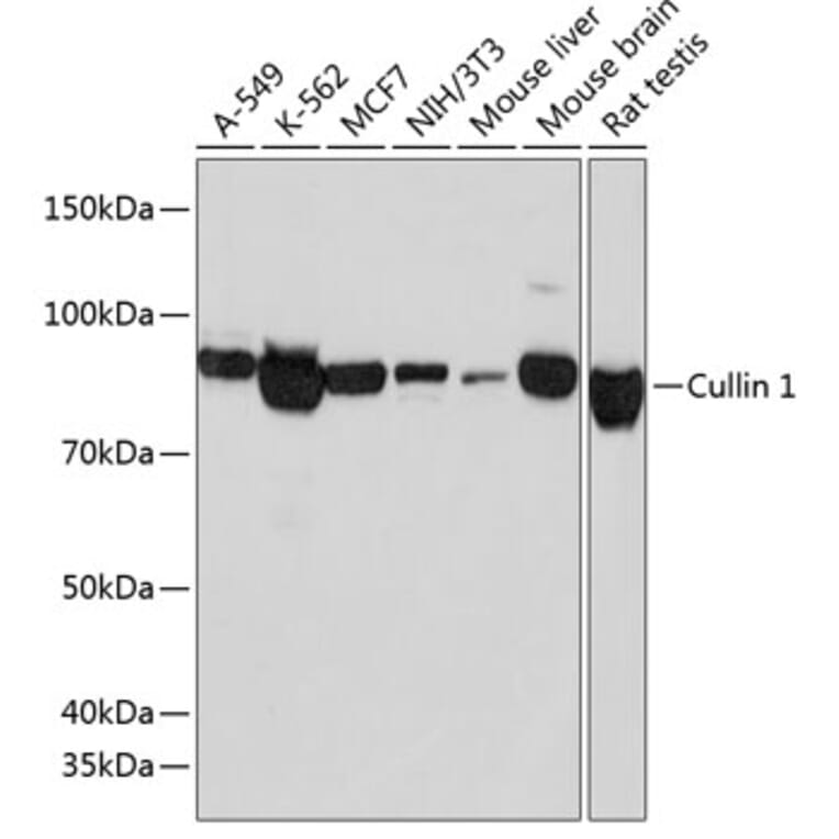 Western Blot - Anti-Cullin 1/CUL-1 Antibody [ARC0436] (A308053) - Antibodies.com