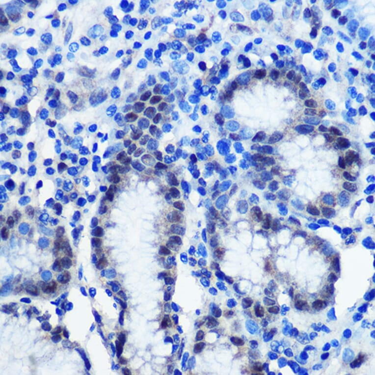 Immunohistochemistry - Anti-Brd4 Antibody (A308054) - Antibodies.com