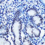 Immunohistochemistry - Anti-Brd4 Antibody (A308054) - Antibodies.com