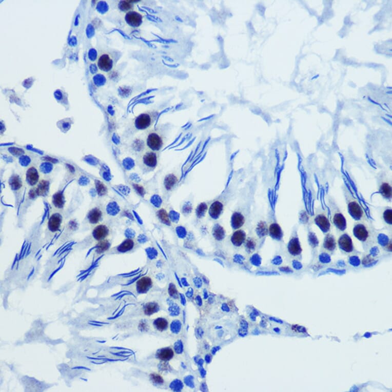 Immunohistochemistry - Anti-Brd4 Antibody (A308054) - Antibodies.com