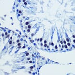 Immunohistochemistry - Anti-Brd4 Antibody (A308054) - Antibodies.com