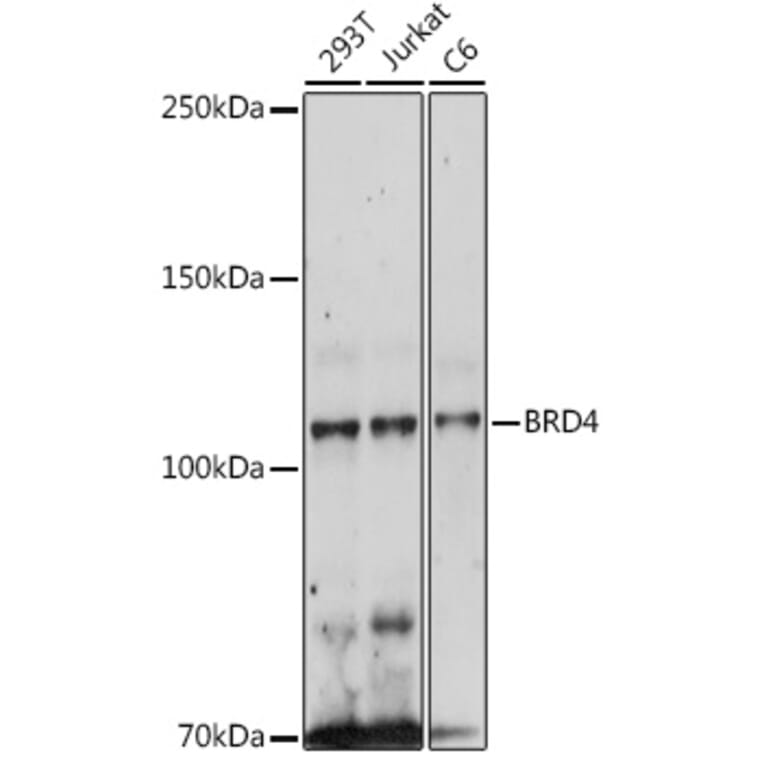 Western Blot - Anti-Brd4 Antibody (A308055) - Antibodies.com