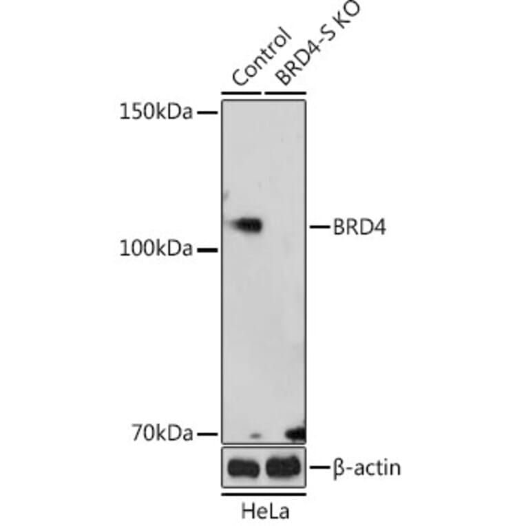 Western Blot - Anti-Brd4 Antibody (A308056) - Antibodies.com