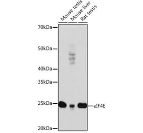 Western Blot - Anti-eIF4E Antibody [ARC0447] (A308059) - Antibodies.com