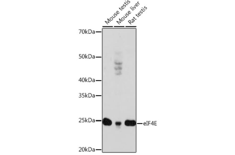 Western Blot - Anti-eIF4E Antibody [ARC0447] (A308059) - Antibodies.com