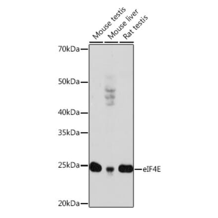 Western Blot - Anti-eIF4E Antibody [ARC0447] (A308059) - Antibodies.com