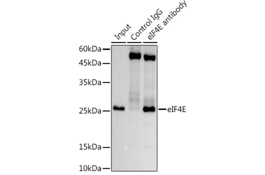 Western Blot - Anti-eIF4E Antibody [ARC0447] (A308059) - Antibodies.com