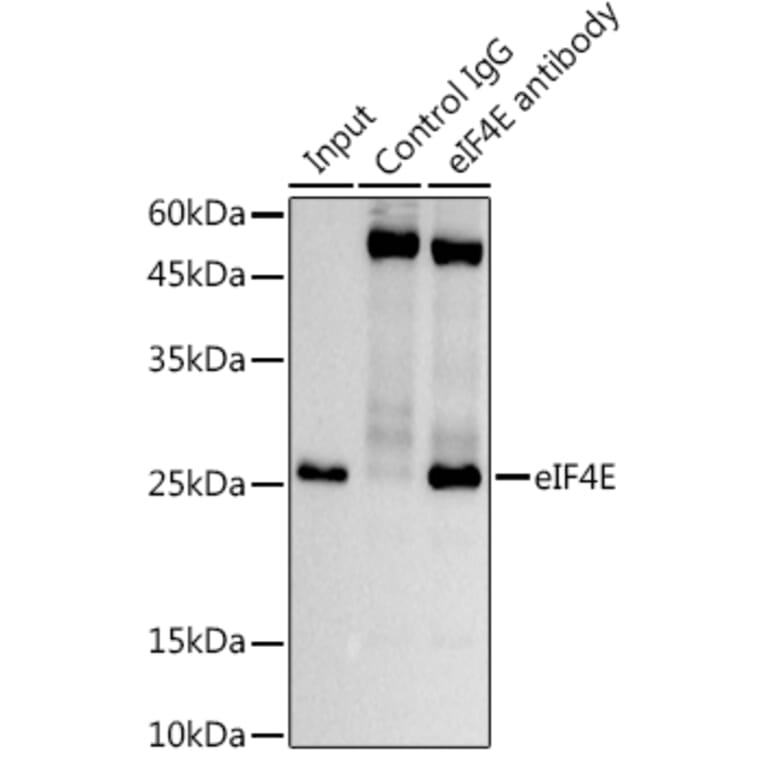 Western Blot - Anti-eIF4E Antibody [ARC0447] (A308059) - Antibodies.com