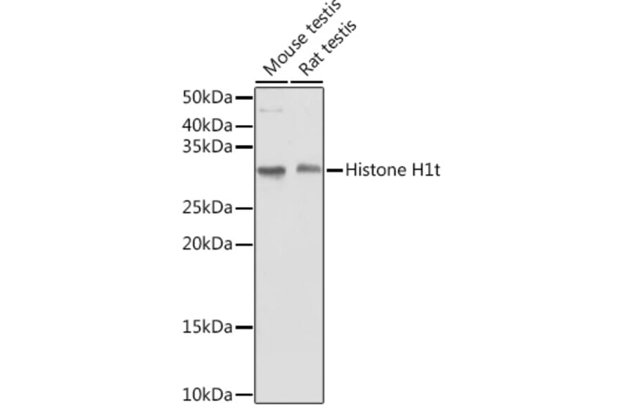 Western Blot - Anti-Histone H1t Antibody (A308060) - Antibodies.com