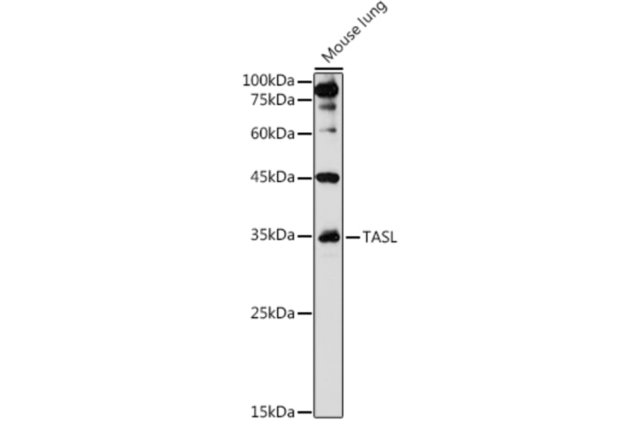 Western Blot - Anti-TASL Antibody (A308062) - Antibodies.com