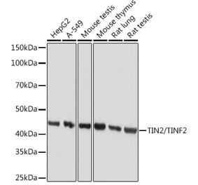 Western Blot - Anti-Tin2 Antibody [ARC1732] (A308063) - Antibodies.com