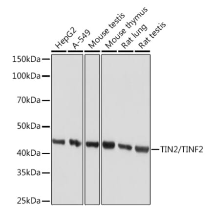 Western Blot - Anti-Tin2 Antibody [ARC1732] (A308063) - Antibodies.com