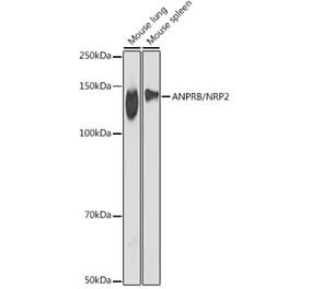 Western Blot - Anti-NPR-B Antibody [ARC2421] (A308065) - Antibodies.com