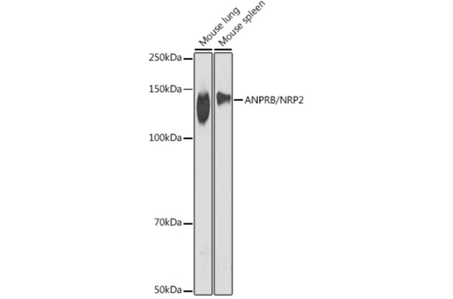 Western Blot - Anti-NPR-B Antibody [ARC2421] (A308065) - Antibodies.com