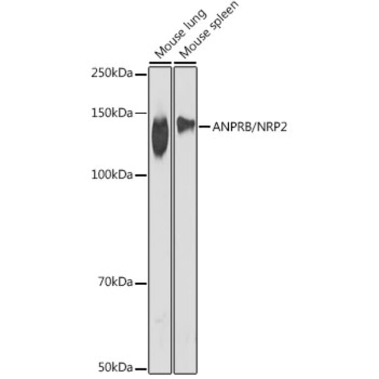 Western Blot - Anti-NPR-B Antibody [ARC2421] (A308065) - Antibodies.com