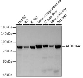 Western Blot - Anti-ALDH16A1 Antibody (A308066) - Antibodies.com