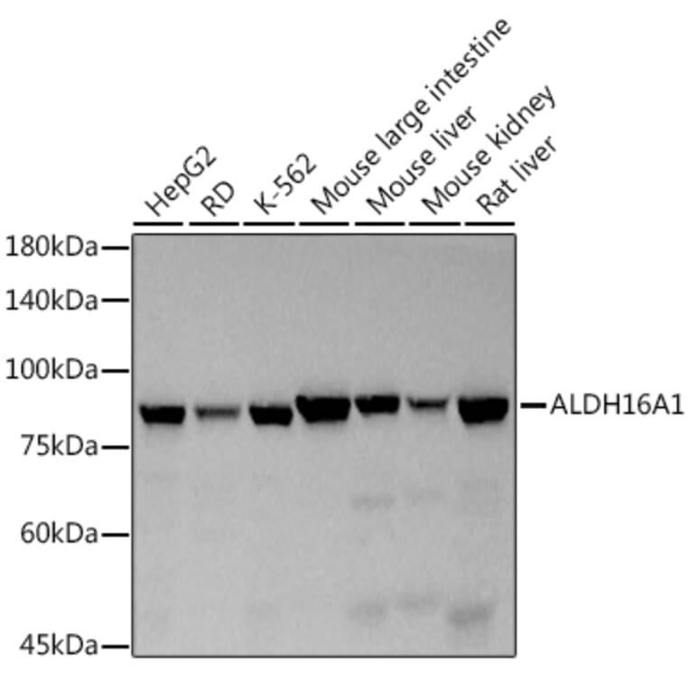Western Blot - Anti-ALDH16A1 Antibody [ARC2762] (A308066) - Antibodies.com