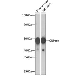 Western Blot - Anti-CNPase Antibody [ARC0388] (A308067) - Antibodies.com