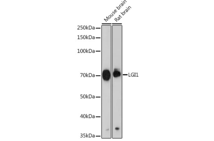 Western Blot - Anti-Lgi1/EPT Antibody [ARC2388] (A308068) - Antibodies.com