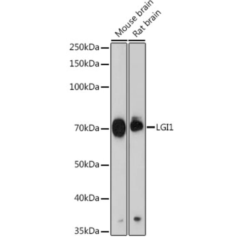 Western Blot - Anti-Lgi1/EPT Antibody [ARC2388] (A308068) - Antibodies.com