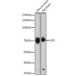 Western Blot - Anti-Lgi1/EPT Antibody [ARC2388] (A308068) - Antibodies.com