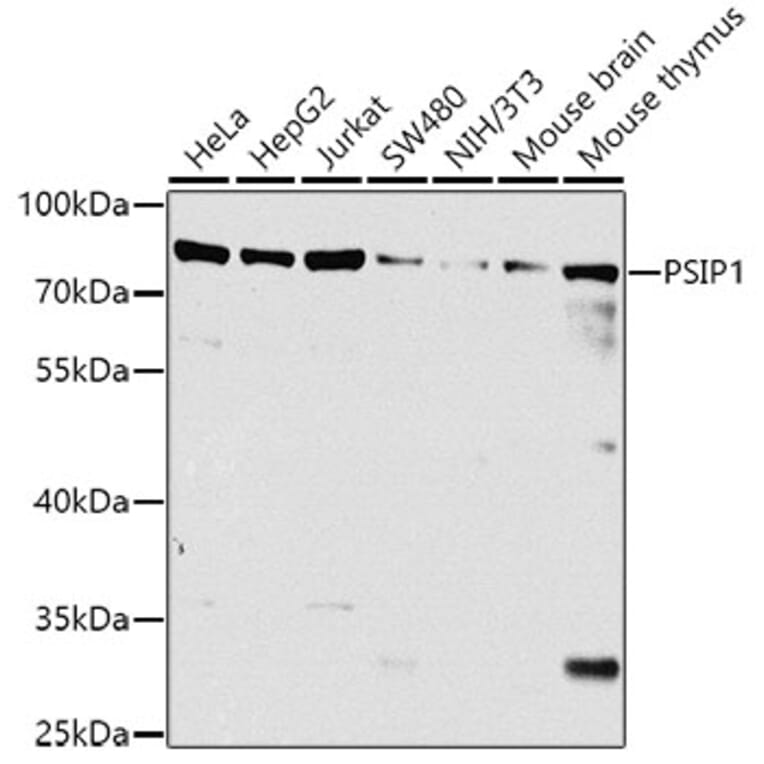 Western Blot - Anti-PSIP1/LEDGF Antibody (A308070) - Antibodies.com