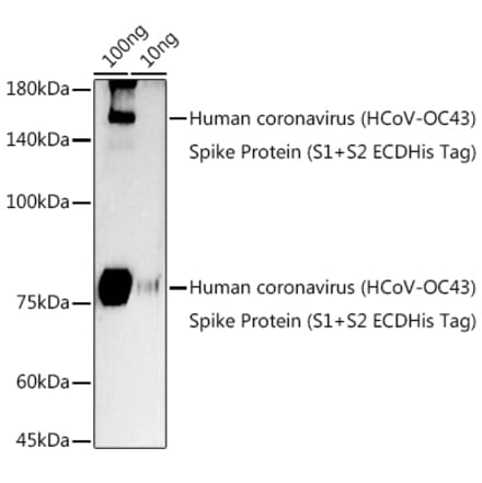 Western Blot - Anti-Human Coronavirus Spike glycoprotein Antibody (A308071) - Antibodies.com