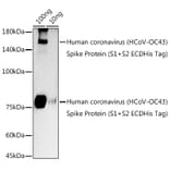 Western Blot - Anti-Human Coronavirus Spike glycoprotein Antibody (A308071) - Antibodies.com