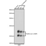 Western Blot - Anti-SARS-CoV2 NSP9 Antibody (A308073) - Antibodies.com