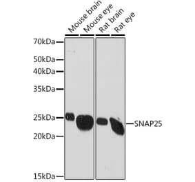 Western Blot - Anti-SNAP25 Antibody [ARC0736] (A308074) - Antibodies.com