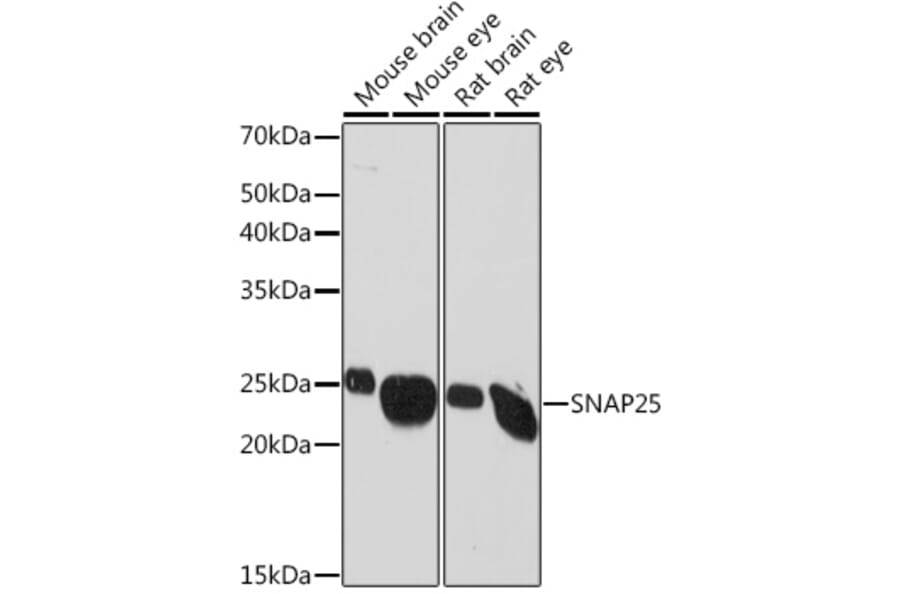 Western Blot - Anti-SNAP25 Antibody [ARC0736] (A308074) - Antibodies.com