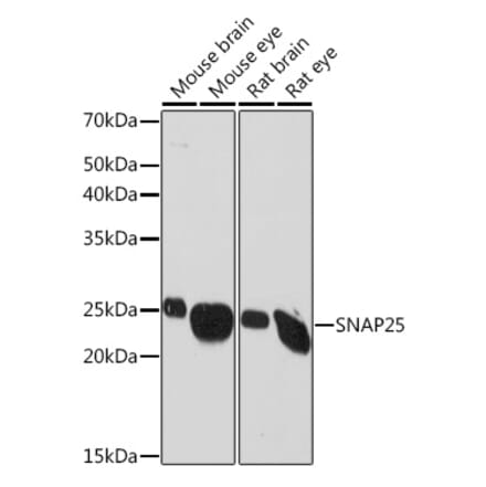 Western Blot - Anti-SNAP25 Antibody [ARC0736] (A308074) - Antibodies.com