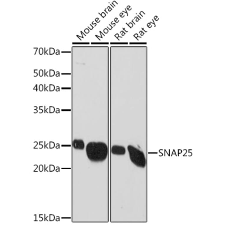 Western Blot - Anti-SNAP25 Antibody [ARC0736] (A308074) - Antibodies.com