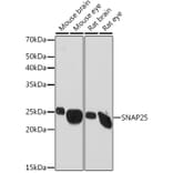 Western Blot - Anti-SNAP25 Antibody [ARC0736] (A308074) - Antibodies.com
