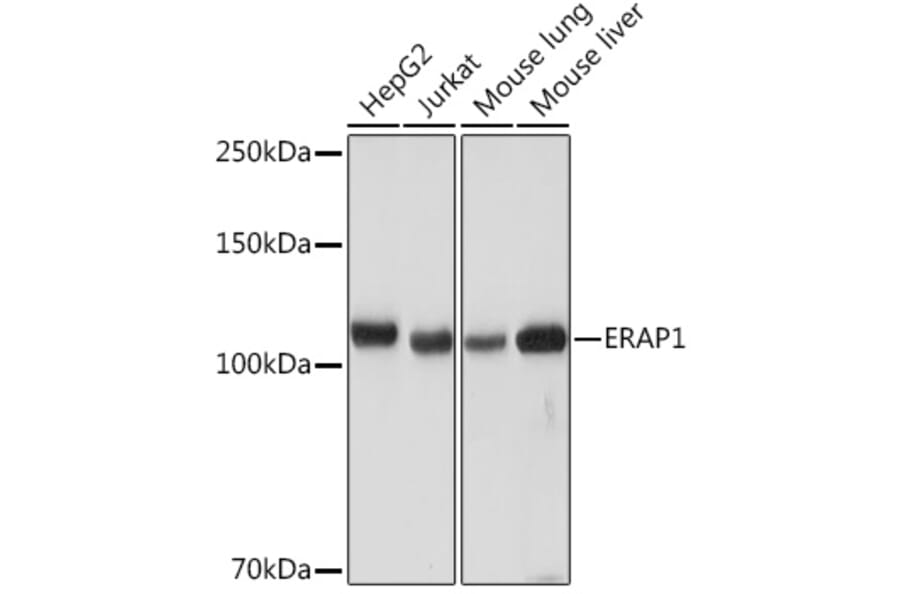Western Blot - Anti-ARTS1/ERAP1 Antibody [ARC2120] (A308078) - Antibodies.com