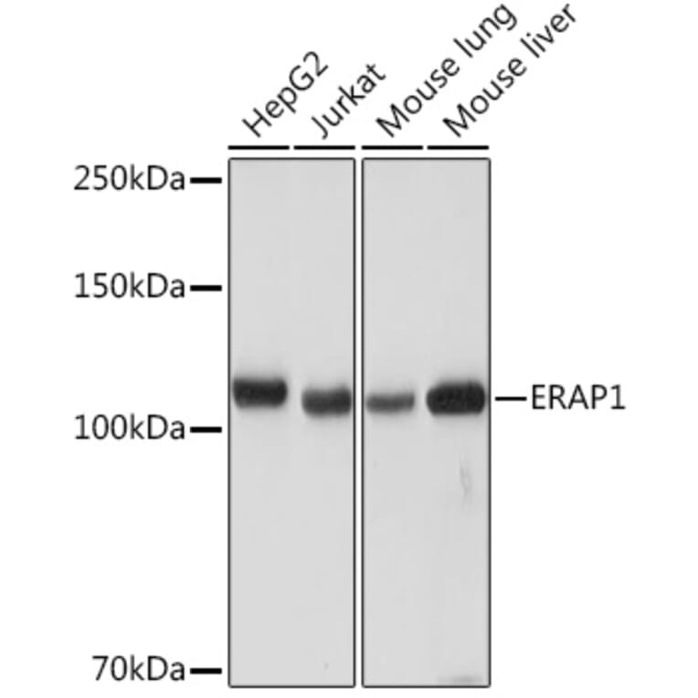 Western Blot - Anti-ARTS1/ERAP1 Antibody [ARC2120] (A308078) - Antibodies.com