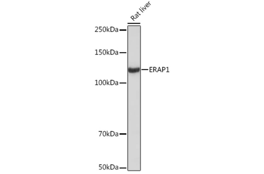 Western Blot - Anti-ARTS1/ERAP1 Antibody [ARC2120] (A308078) - Antibodies.com