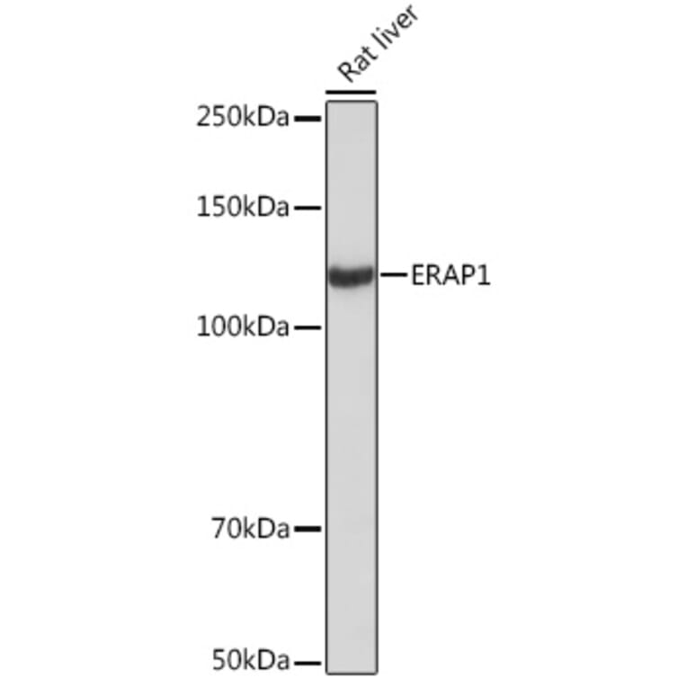 Western Blot - Anti-ARTS1/ERAP1 Antibody [ARC2120] (A308078) - Antibodies.com