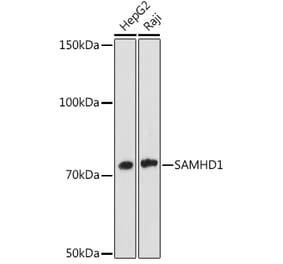 Western Blot - Anti-SAMHD1 Antibody [ARC1050] (A308079) - Antibodies.com