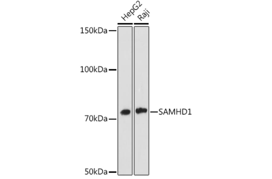 Western Blot - Anti-SAMHD1 Antibody [ARC1050] (A308079) - Antibodies.com