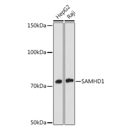 Western Blot - Anti-SAMHD1 Antibody [ARC1050] (A308079) - Antibodies.com