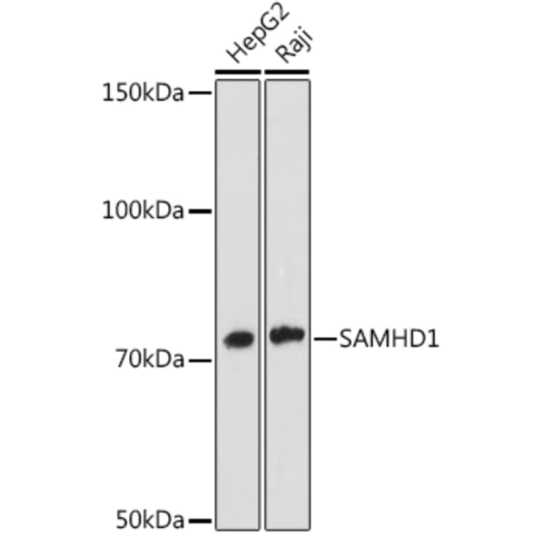 Western Blot - Anti-SAMHD1 Antibody [ARC1050] (A308079) - Antibodies.com