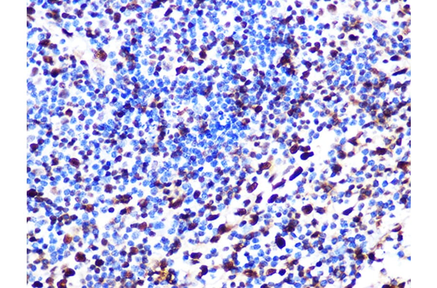 Immunohistochemistry - Anti-SAMHD1 Antibody [ARC1050] (A308079) - Antibodies.com