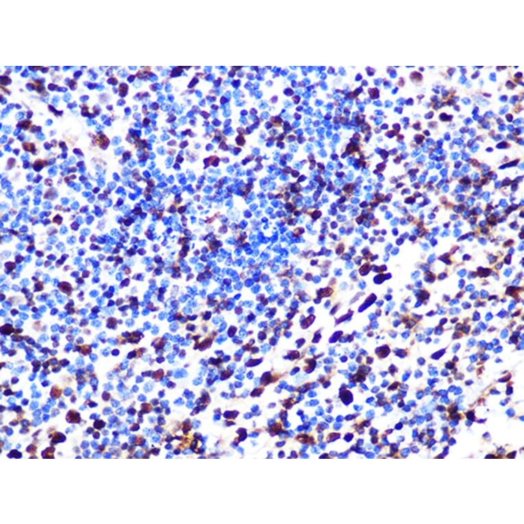 Immunohistochemistry - Anti-SAMHD1 Antibody [ARC1050] (A308079) - Antibodies.com